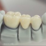 کاربرد پرینتر سه بعدی در دندانپزشکی