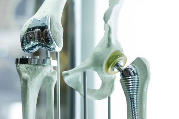 کاربرد پرینتر سه بعدی در بازسازی استخوان پا