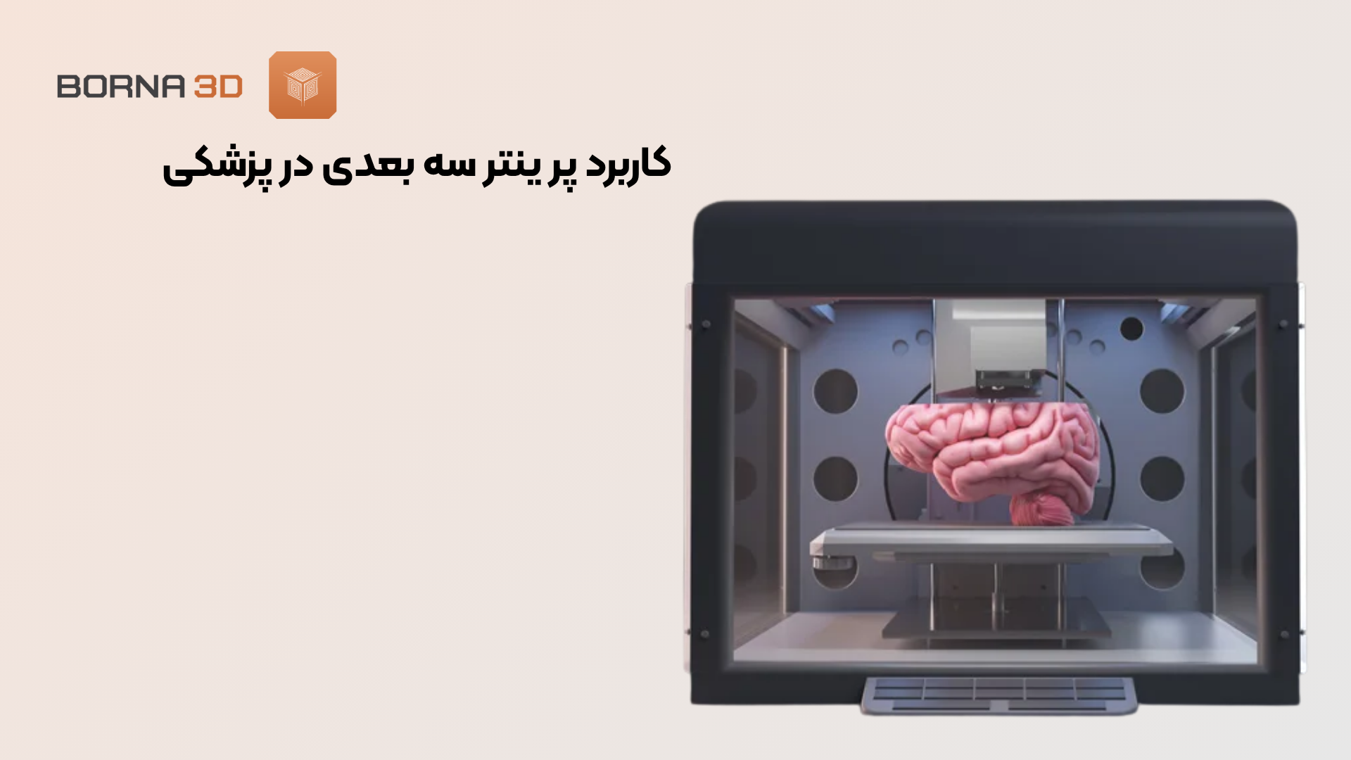 کاربرد پرینتر سه بعدی در پزشکی